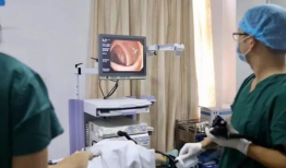 肠镜怎么做的过程视频,直观视频带你了解每一步